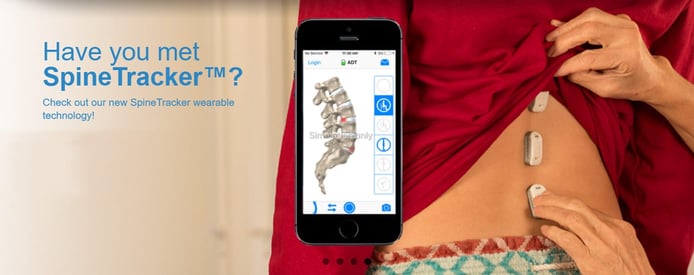 The Gokhale SpineTracker