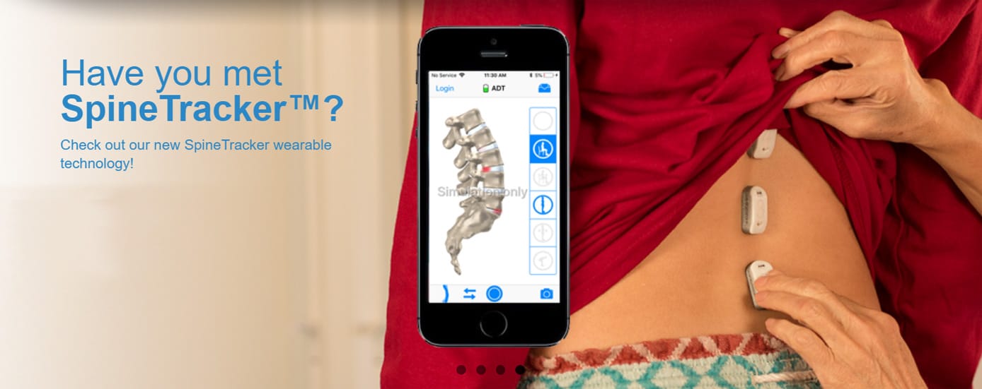 The Gokhale SpineTracker The Gokhale SpineTracker